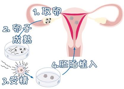 借卵代怀代生生殖医学中心